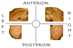 Human atlas facets; superior view