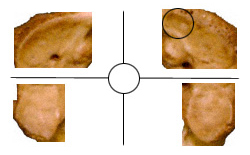 Human atlas facets; superior view